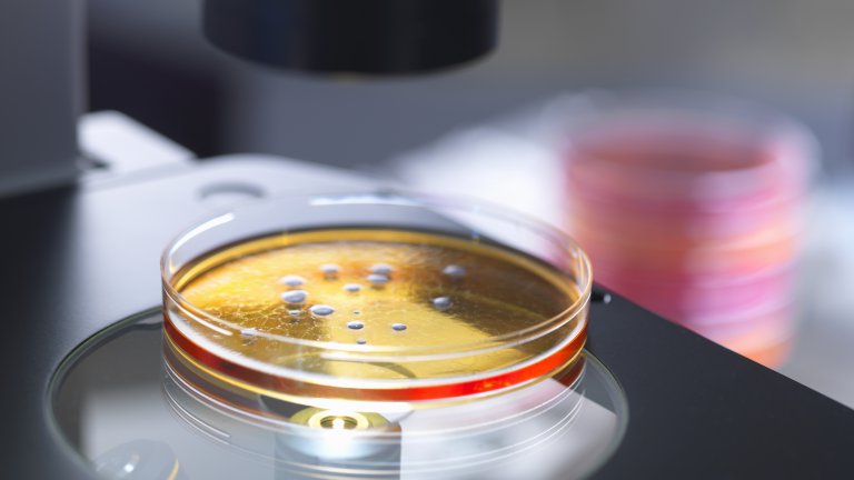 Petri dish under a microscope Petri dish under a microscope