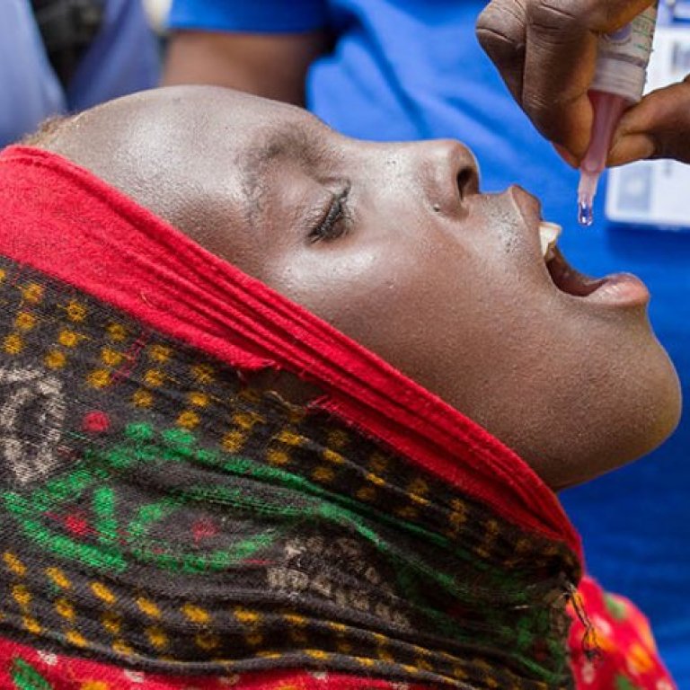 Child in Africa gets a polio vaccine